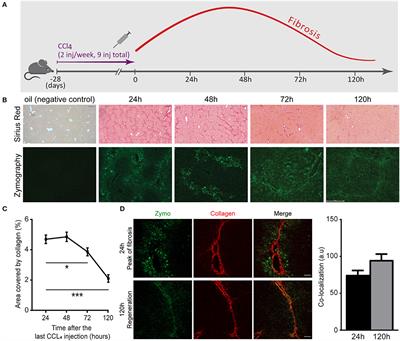 LOXL2 Inhibition Paves the Way for Macrophage-Mediated Collagen Degradation in Liver Fibrosis